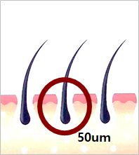 모공 약 50µm
