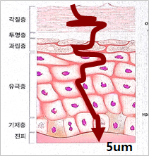 두피 세포 간격 약 5µm